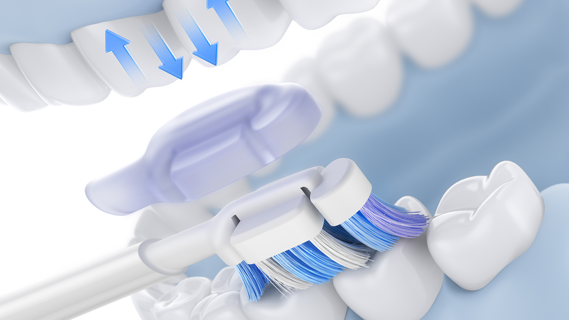 электрическая зубная щетка