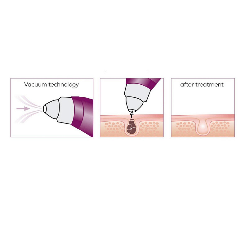 Масажер Beurer для обличчя вакуумний, акумулятор, USB, 3 режими, білий