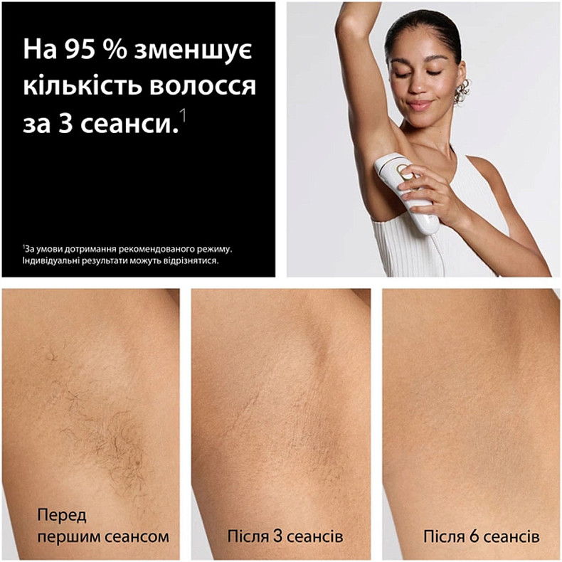 Фотоэпилятор Braun PL5412